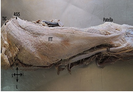 Morphometry of iliotibial tract and its surgical importance: an anatomical study